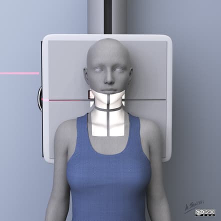 cervical spin ap positioning