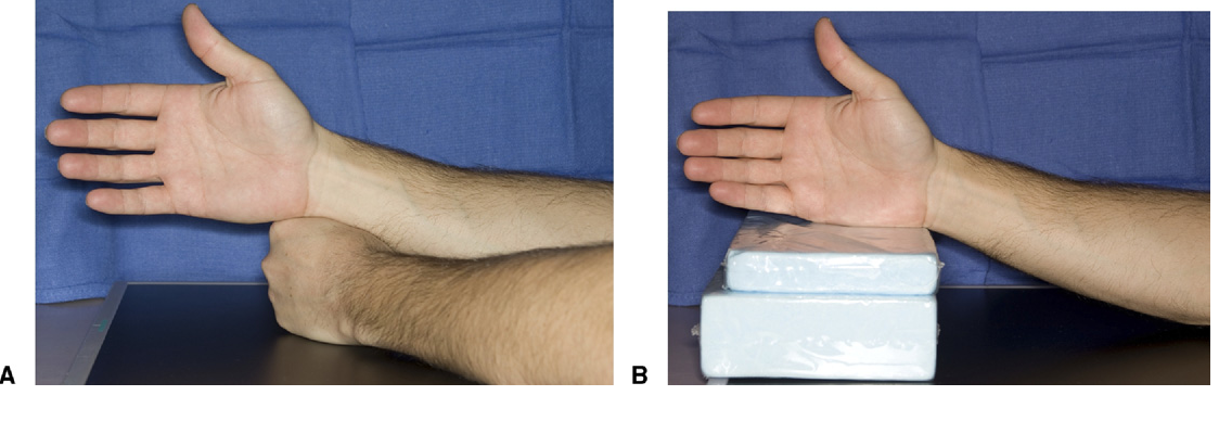 Lateral wrist set-up